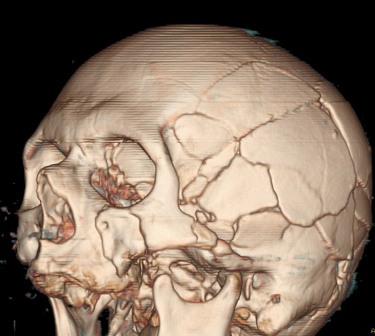 Комп'ютерна томографія КТ головного мозку в Черкасах