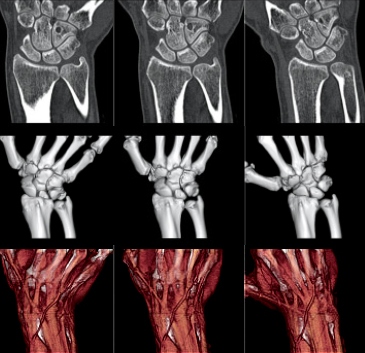 Комп'ютерна томографія КТ хребта в Черкасах