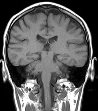 томографія головного мозку Черкаси