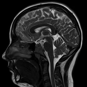 томографія мозку Черкаси