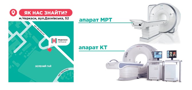 ціни кт мрт Черкаси