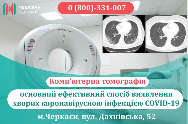 Комп'ютерна томографія КТ легень ковід